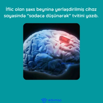 İflic olan şəxs beyninə yerləşdirilmiş cihaz sayəsində "sadəcə düşünərək" tvitini yazıb